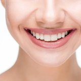 Close-up of a smiling woman's teeth